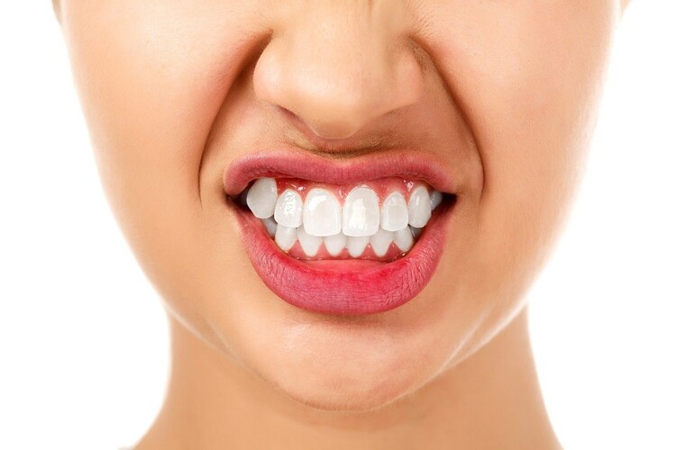 دندان قروچه یا براکسیسم علائم، علت و درمان