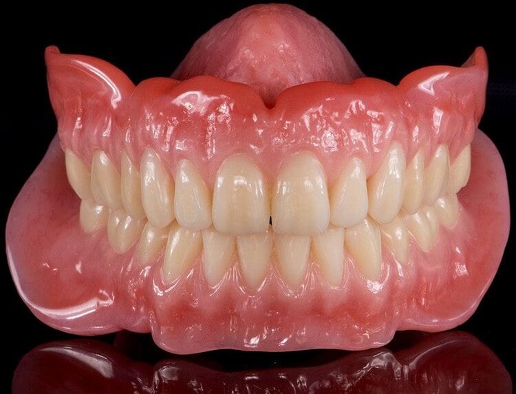 پروتزهای کامل دندان
